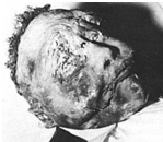 Emmett Till- Civil Rights and Influence Emmett Till- Civil Rights and Influence